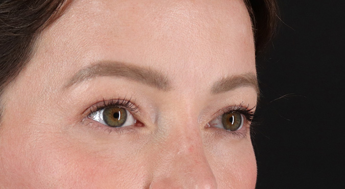 After - right_oblique