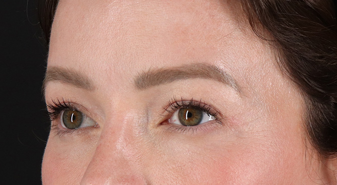 After - left_oblique