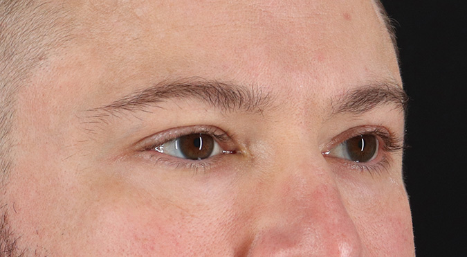 After - right_oblique