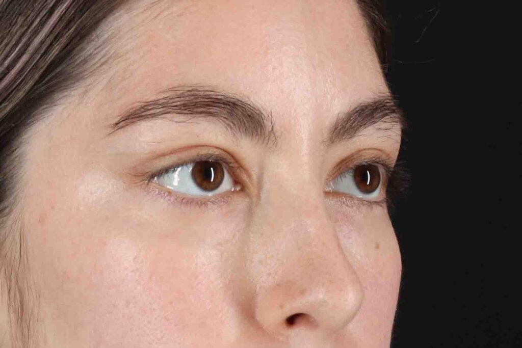 After - right_oblique