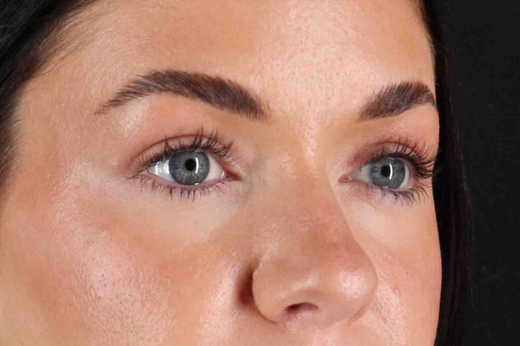 After - right_oblique