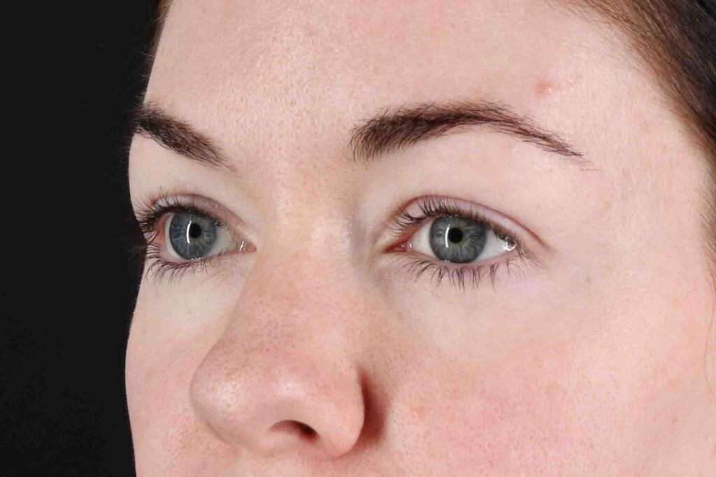 Before - left_oblique