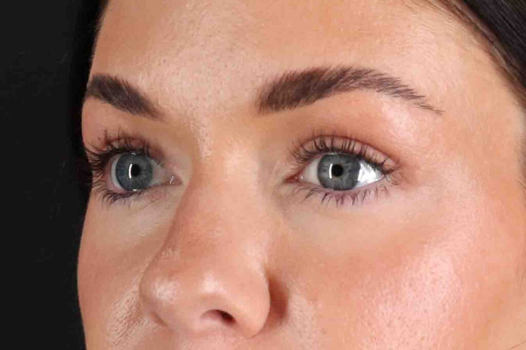 After - left_oblique