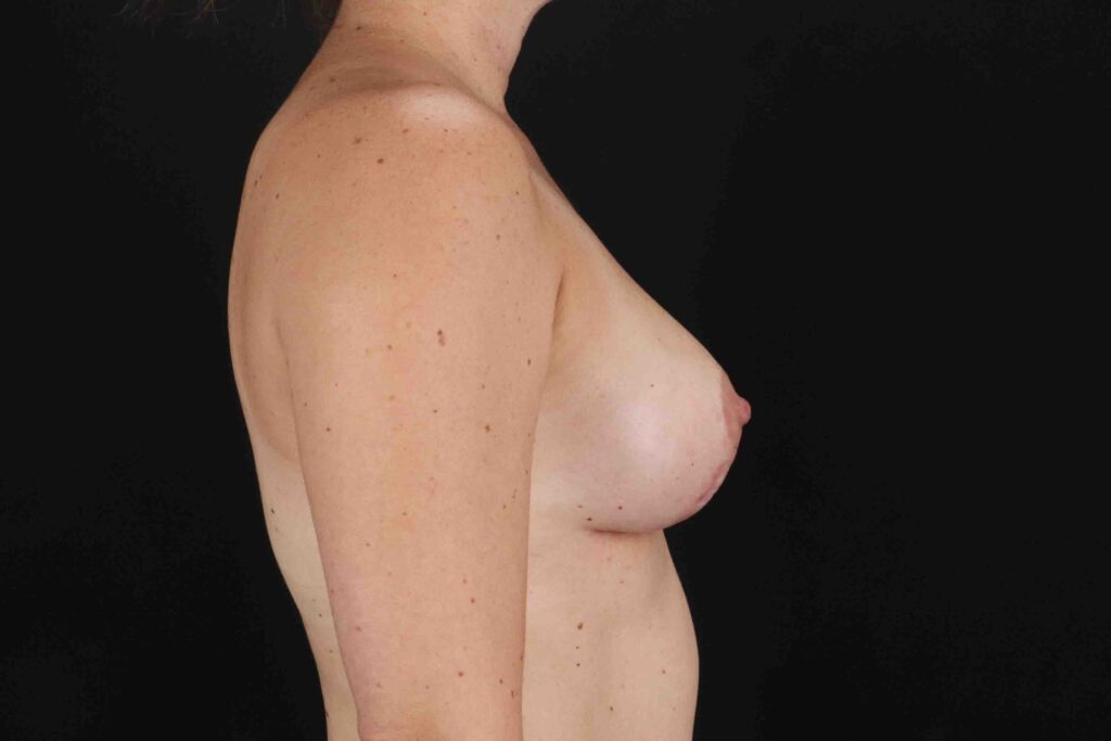 After - right_lateral