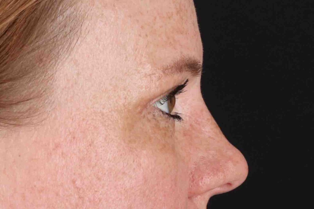 After - right_lateral