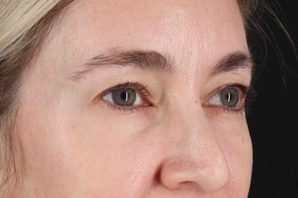 Before - right_oblique