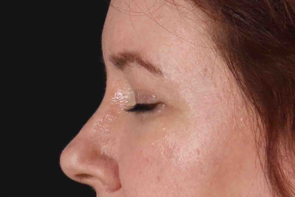 After - left_lateral