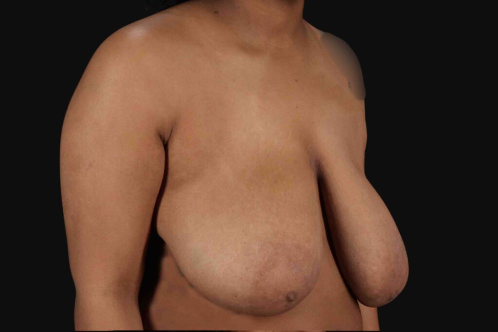 Before - right_oblique