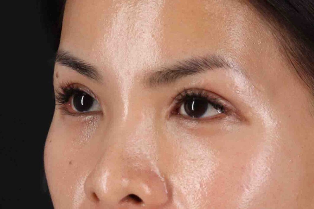 After - left_oblique