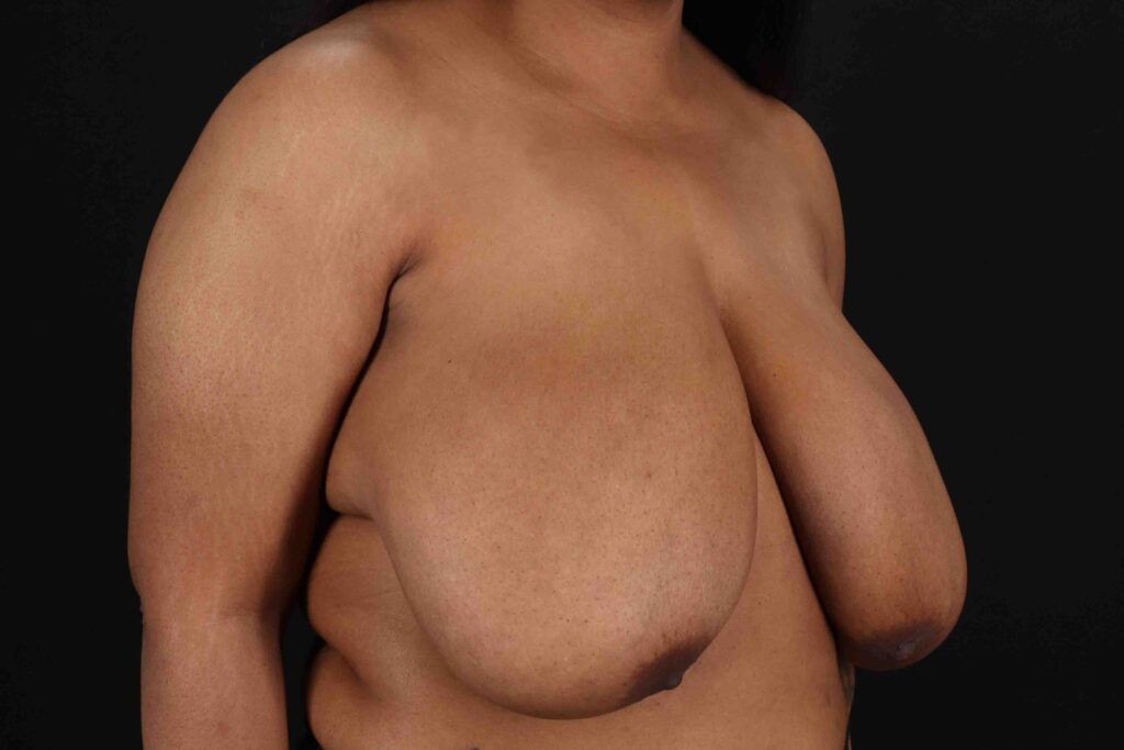 Before - right_oblique