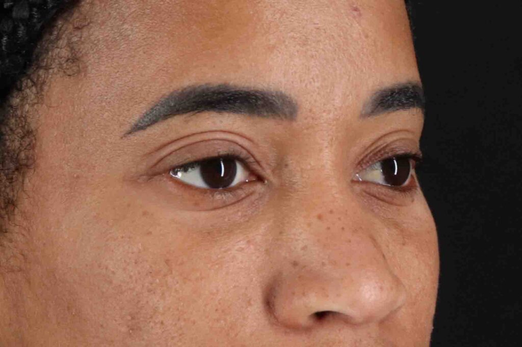 Before - right_oblique