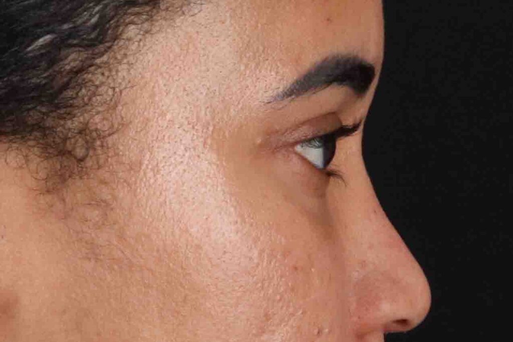 After - right_lateral