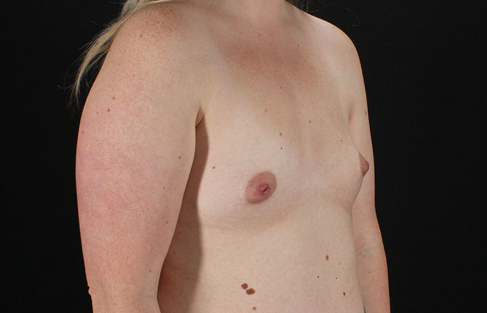 Before - right_oblique