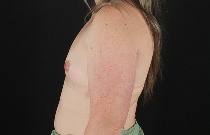 Before - left_lateral