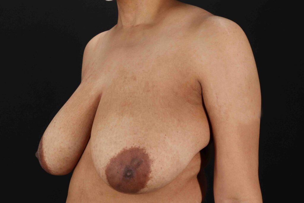 Before - left_oblique