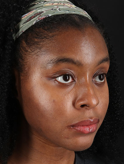 After - right_oblique