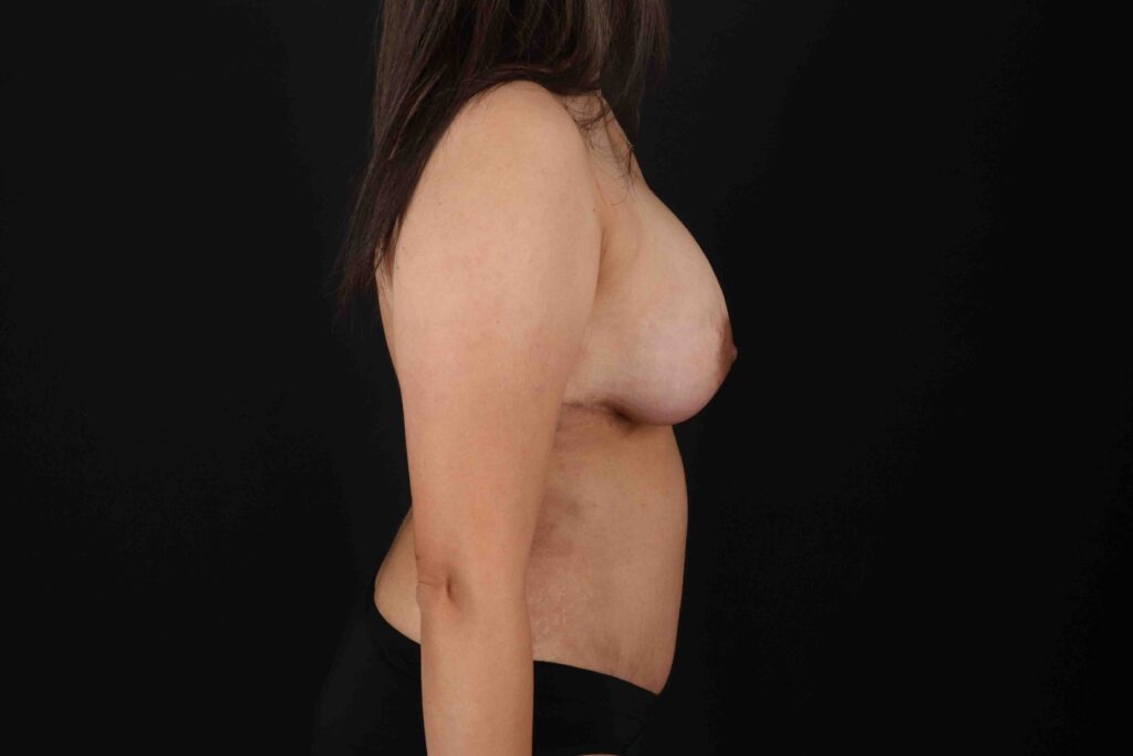 After - right_lateral