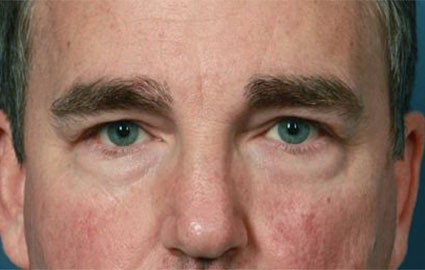 Before - 00710