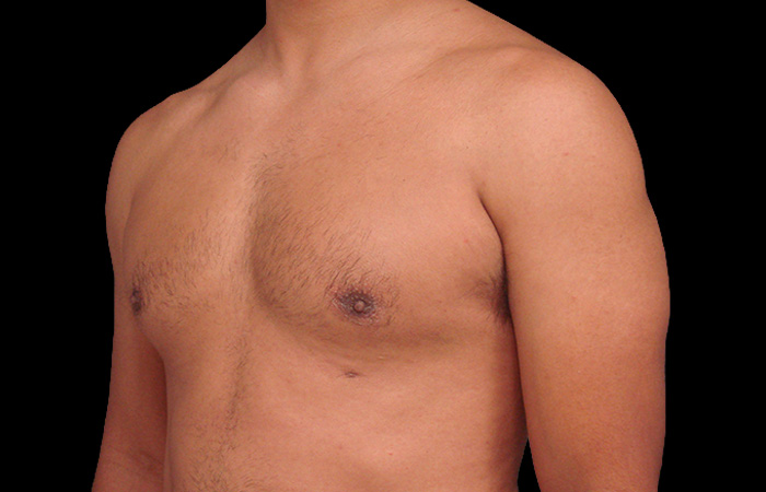 After - left_oblique