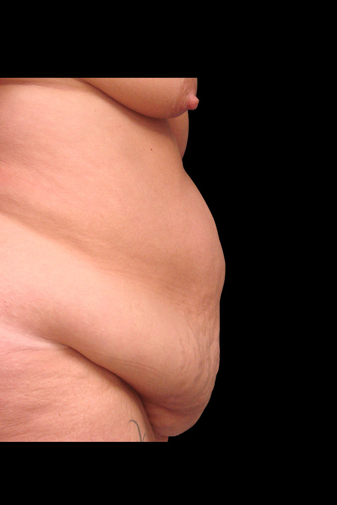 Before - right_lateral