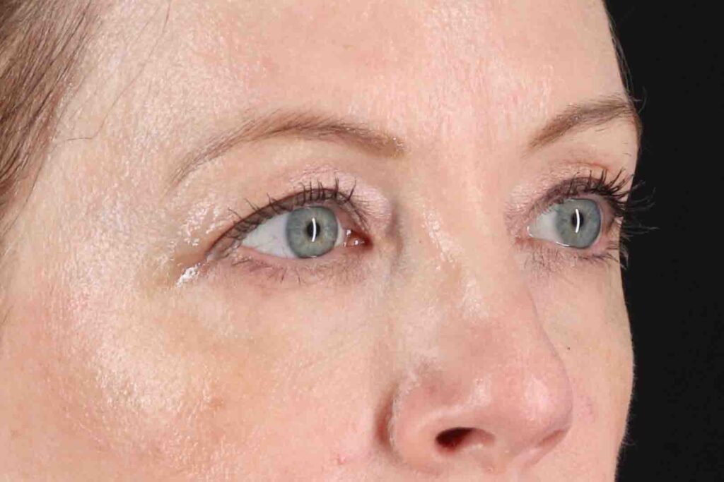 Before - right_oblique