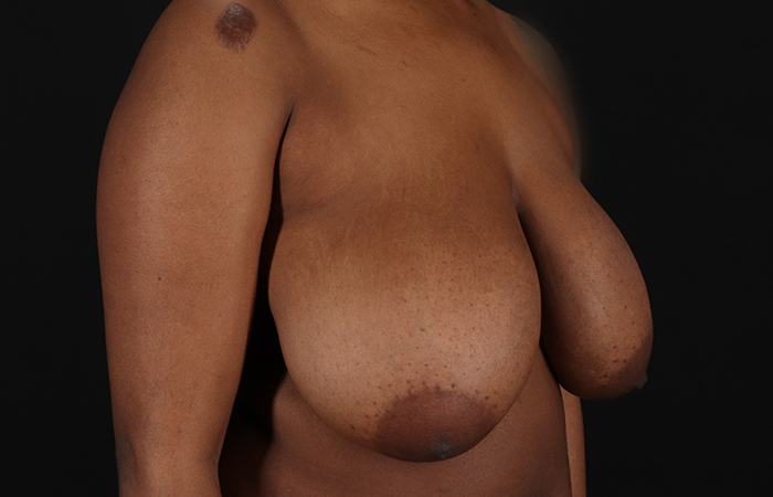 Before - right_oblique