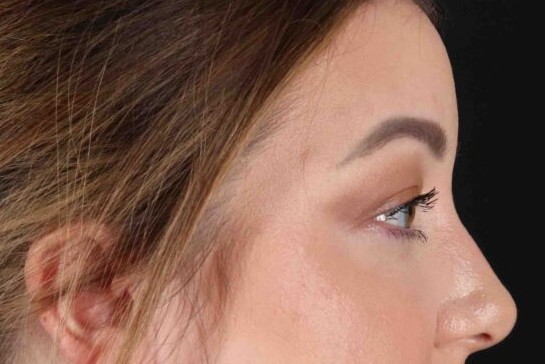 After - right_lateral